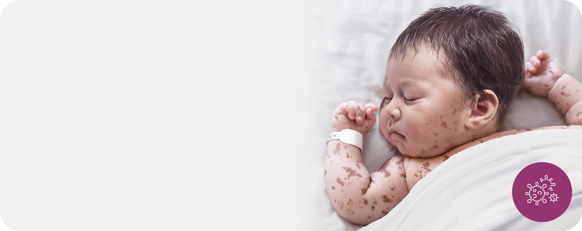 ภาวะติดเชื้อในกระแสเลือด